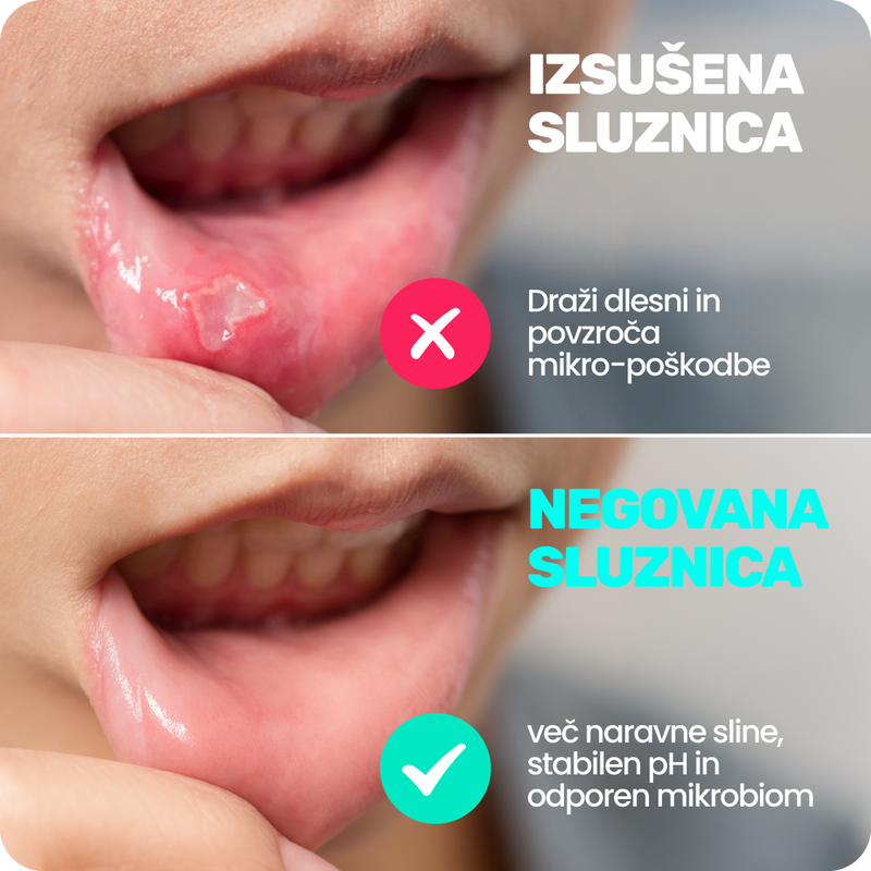 6. Ker izsušena sluznica poruši mikrobiom zato se slab zadah, vnetja ter obloge hitreje vračajo