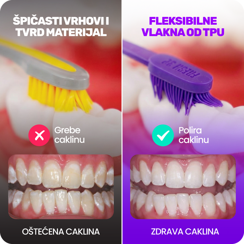 2. Jer većina ljudi ne zna da najlonske četkice uzrokuju mikro-oštećenja na caklini što dovodi do hrapavosti, osjetljivosti i žućkastih zuba