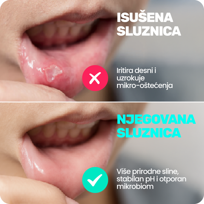 5. Nježna i sigurna za osjetljiva usta