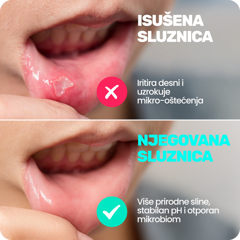6. Jer isušena sluznica narušava mikrobiom pa se zadah, upale i plak brže vraćaju
