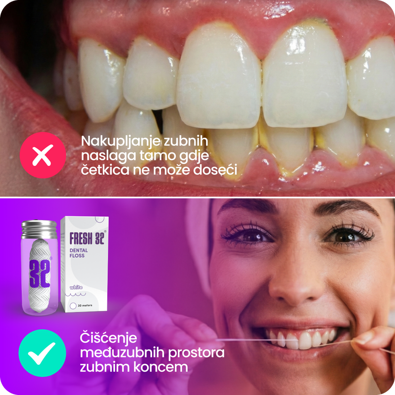 7. Jer se najviše bakterija skriva među zubima – gdje četkica ne može dosegnuti