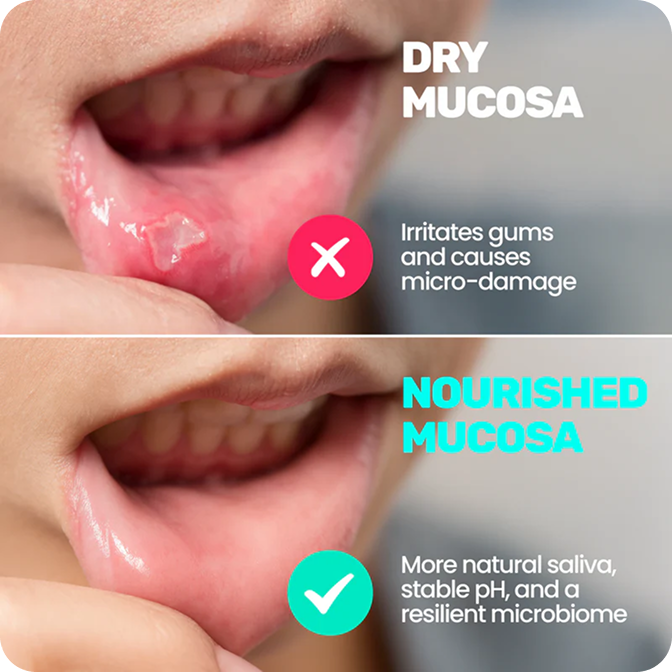 Dry mouth wrecks the microbiome