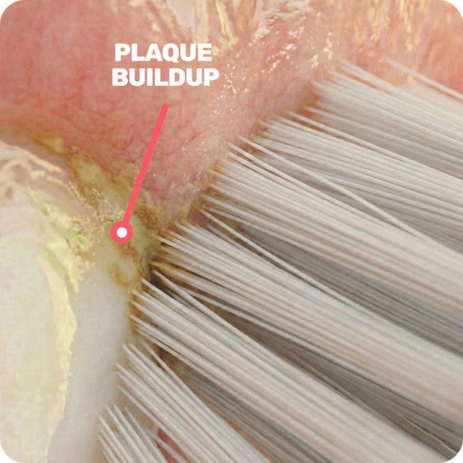 Traditional bristle materials are too rigid