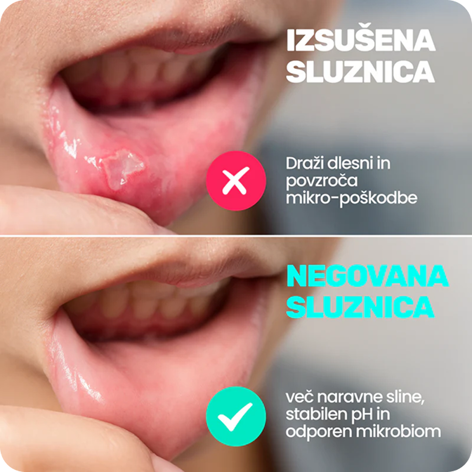 Suha usta porušijo mikrobiom
