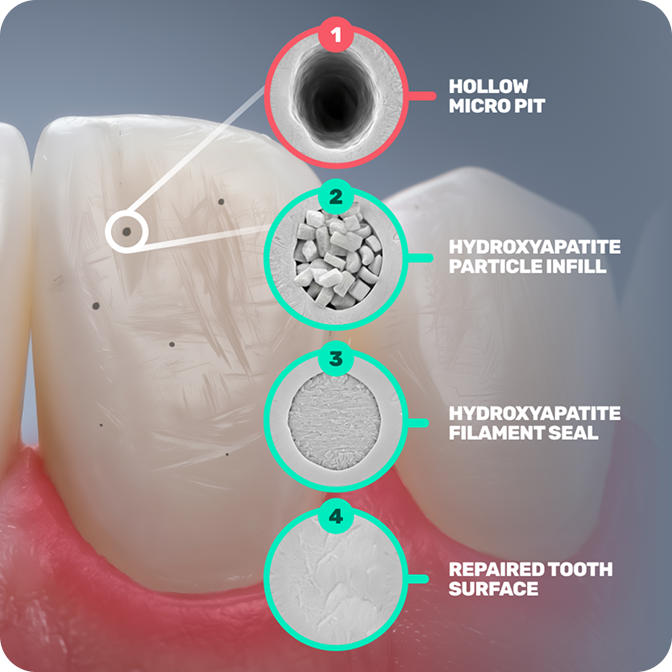 HAp toothpaste to smooth enamel and support brightness