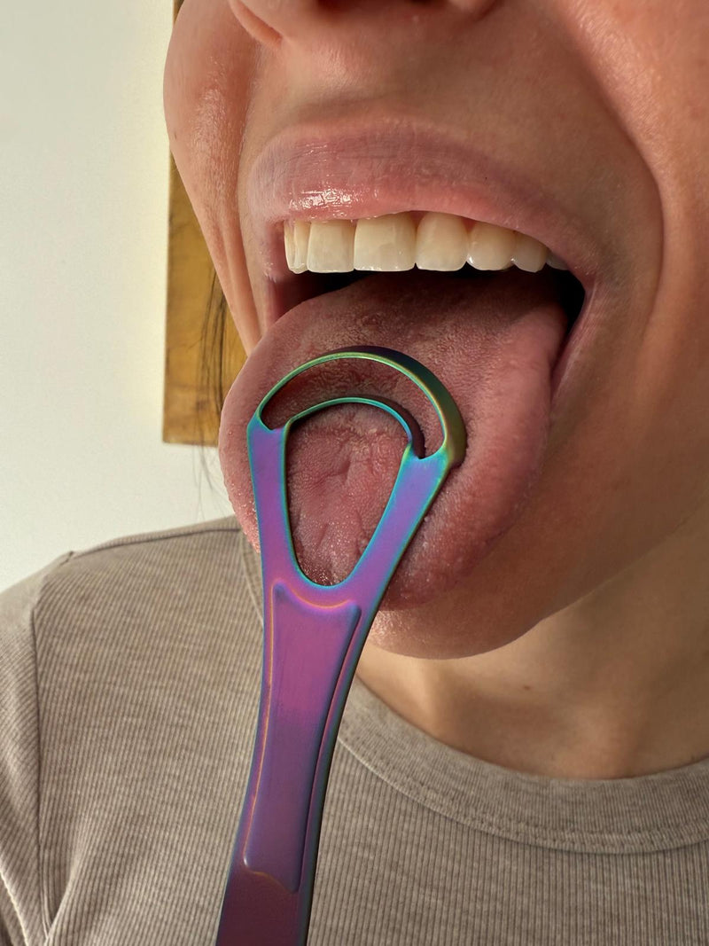 Nisem vedela, da to sploh potrebujem